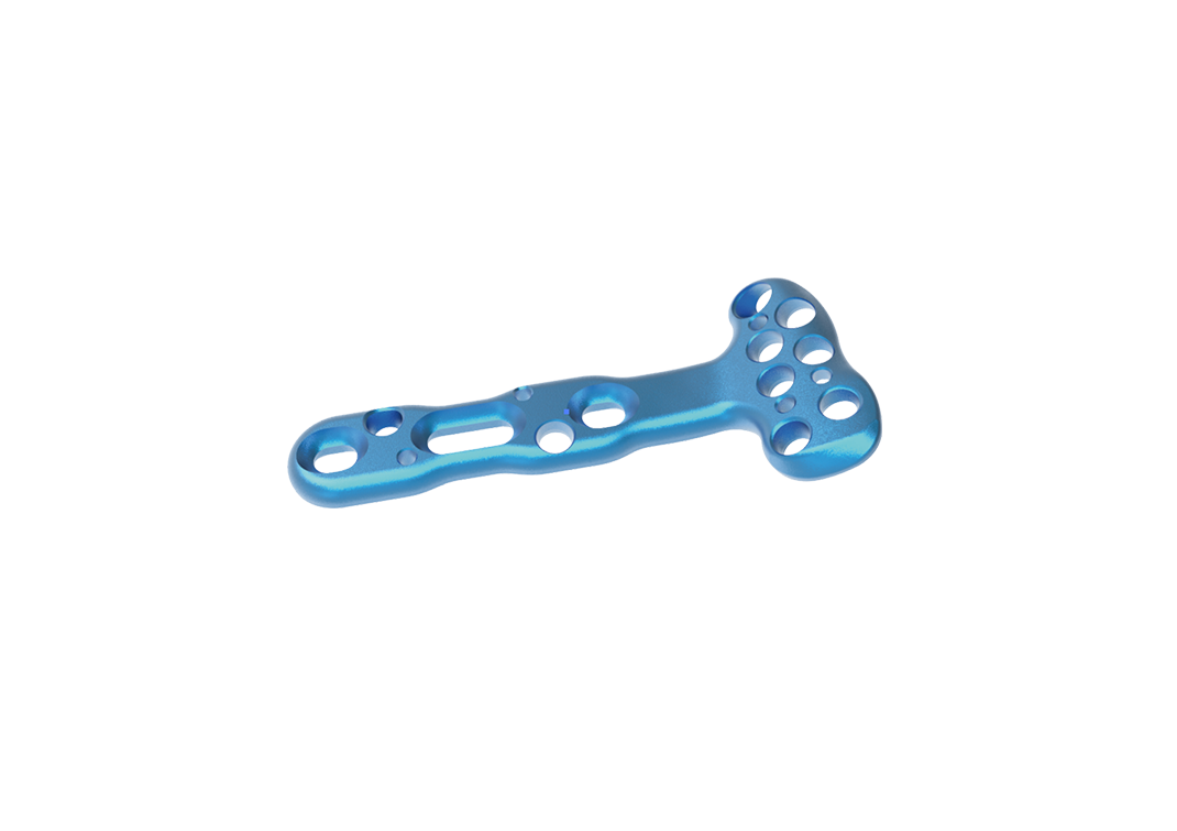 Distal Radius Palmar Locking Compression Plate-11
